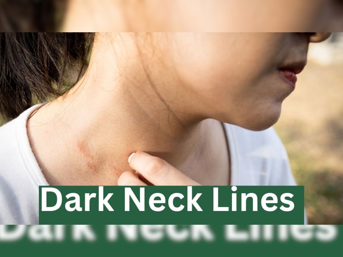 Dark Circles On Neck: गर्दन पर काले घेरे को न करें इग्नोर, इस बीमारी की हो सकती है शुरुआत