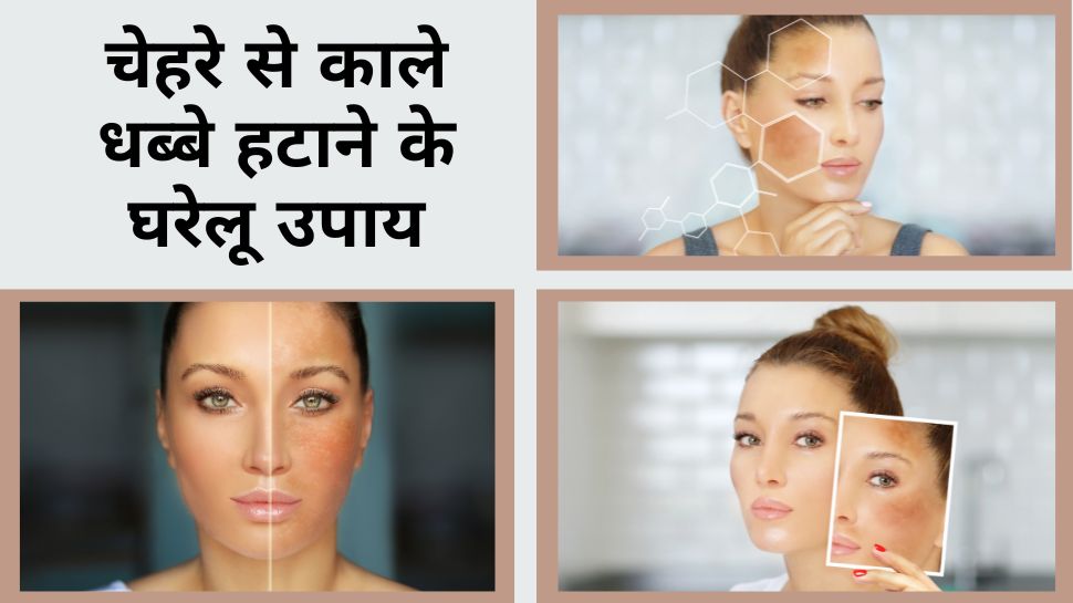 Dark Spots Removal Home Remedies To Remove Black Spots From Face In dark-spots-removal-home-remedies-to-remove-black-spots-from-face-in