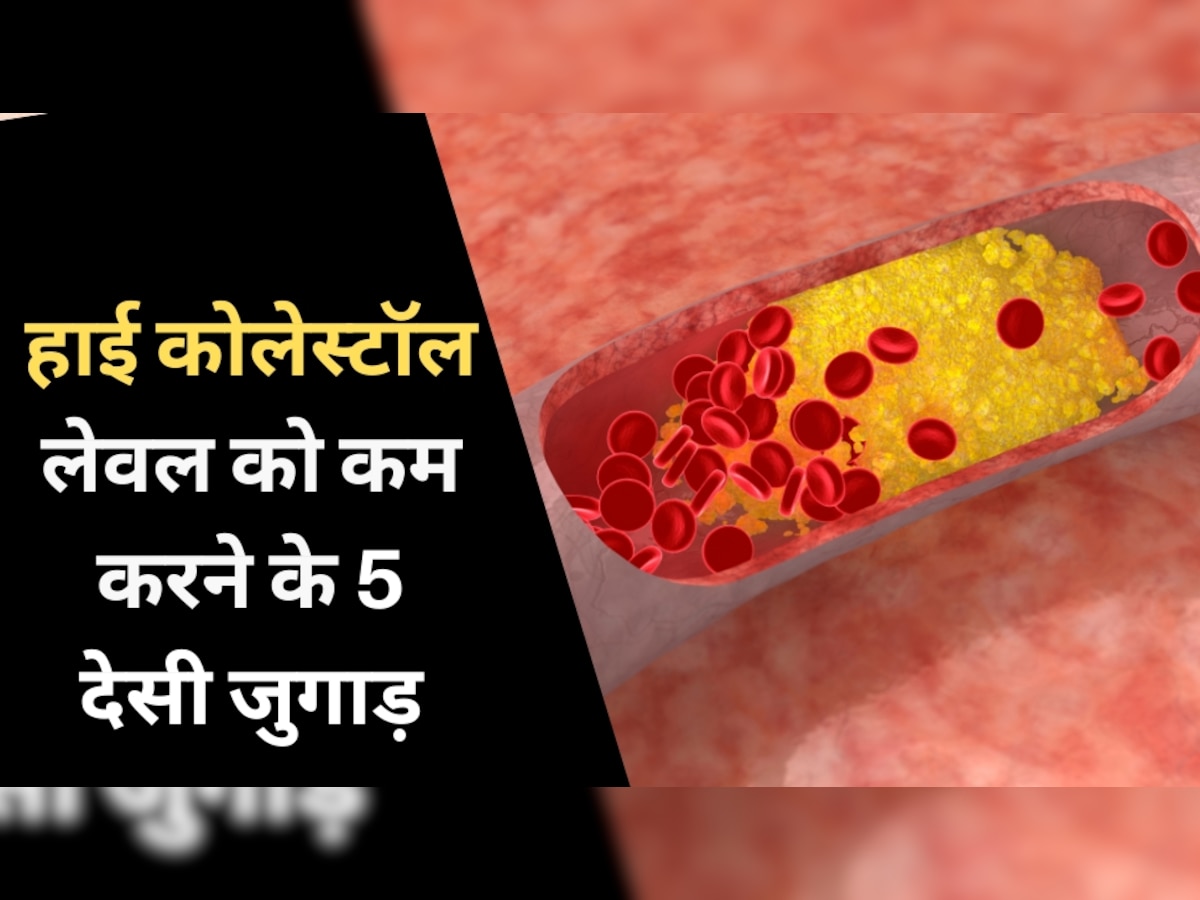 खून को नसों से पास नहीं होने देता LDL Cholesterol, जानें हाई कोलेस्ट्रॉल लेवल को कम करने के 5 देसी जुगाड़