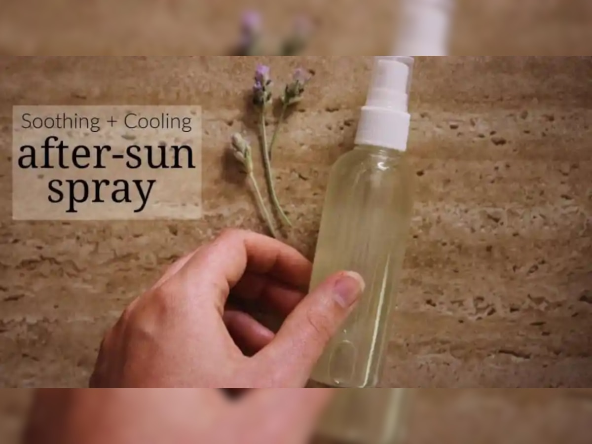 Summer Skin Care: तेज धूप से स्किन को करना चाहते हैं Protect, तो घर पर बनाएं After Sun Spray