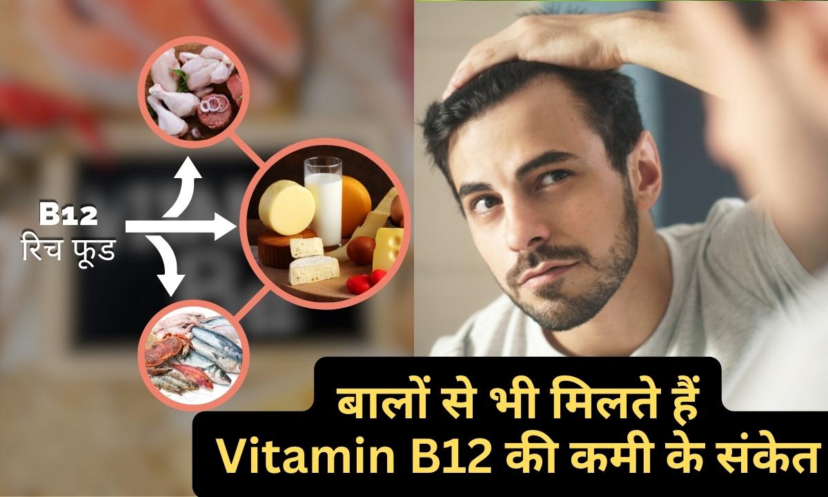 Vitamin B12 Deficiency changes in hair indicate deficiency of b12 start