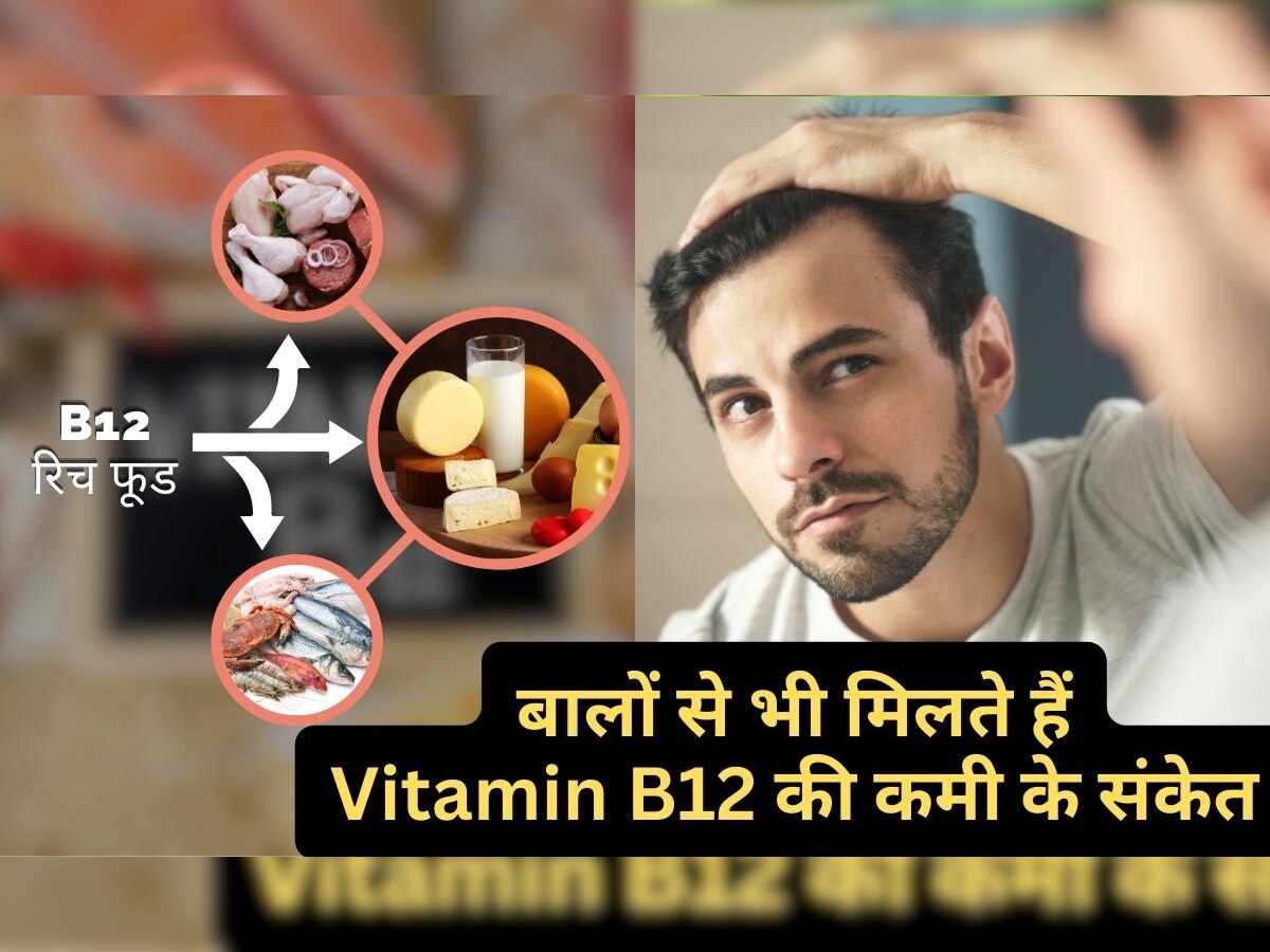 Vitamin B12 Deficiency: बालों में ये परिवर्तन देते हैं विटामिन बी12 की कमी के संकेत, आज से खाना शुरु करें 5 चीजें