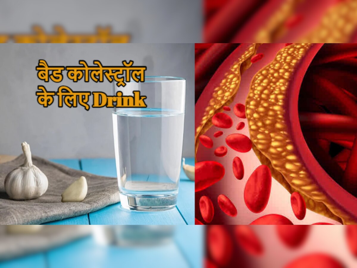 Cholesterol Drink: शरीर से बैड कोलेस्ट्रॉल को खींचकर बाहर कर देगा ये स्पेशल पानी, ऐसे बनाएं