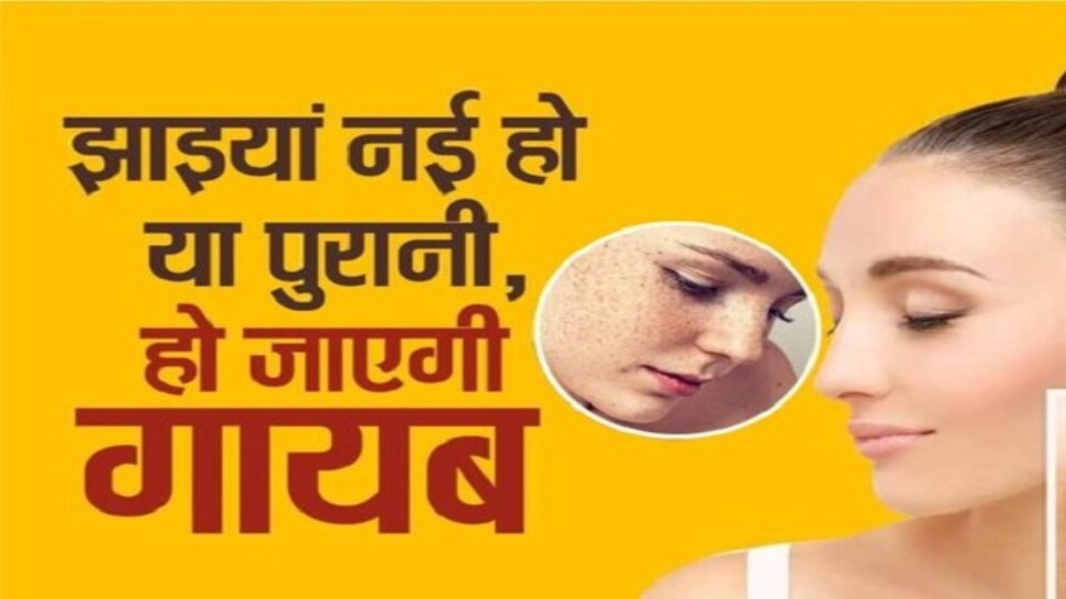 Home Remedies To Get Rid Of Pigmentation Skin Care Hindi News, चेहरे