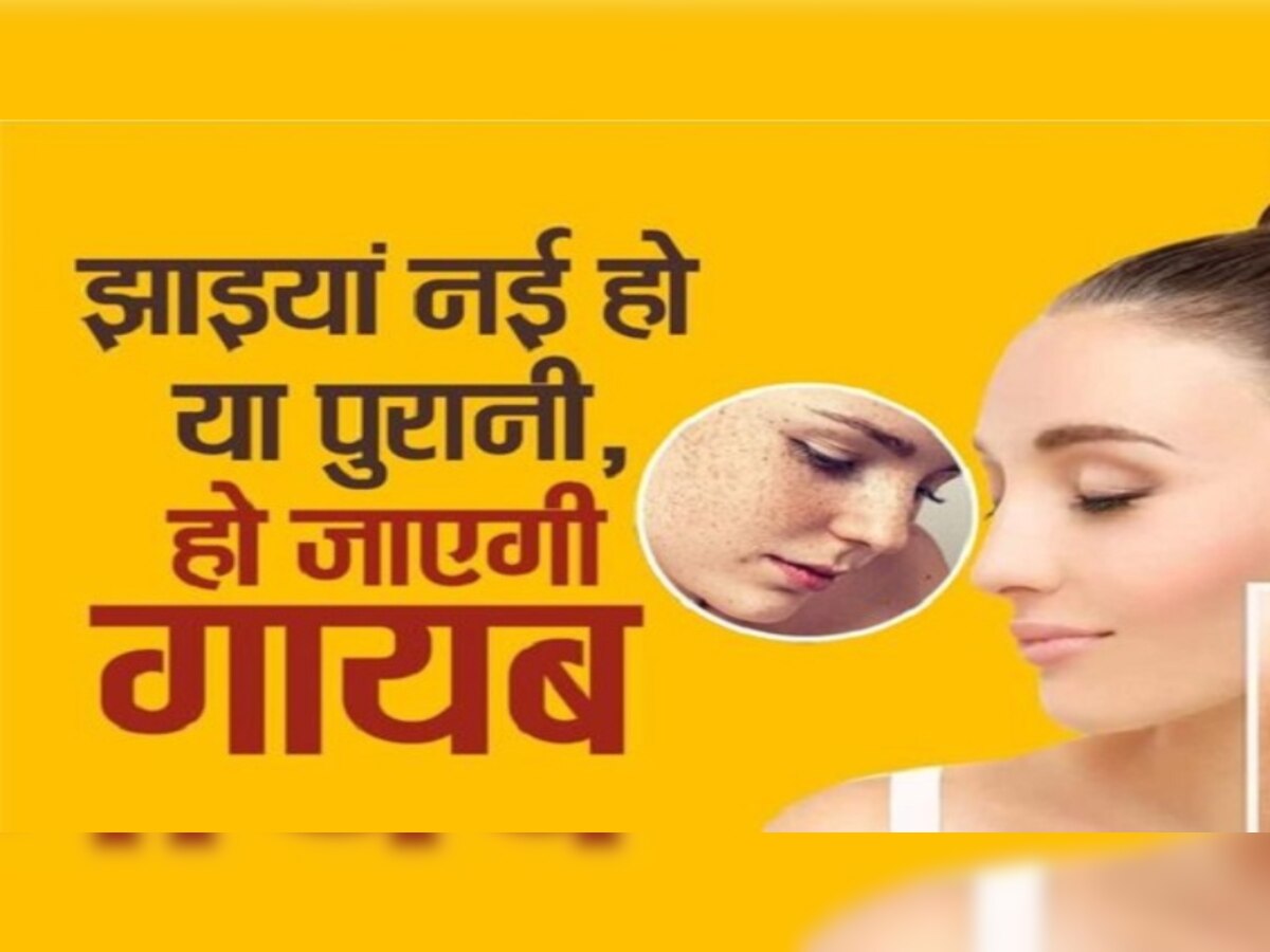 Pigmentation Treatment: चेहरे की झाइयों को दूर कर देंगी किचन की ये चीजें, स्किन पर भी आएगा निखार