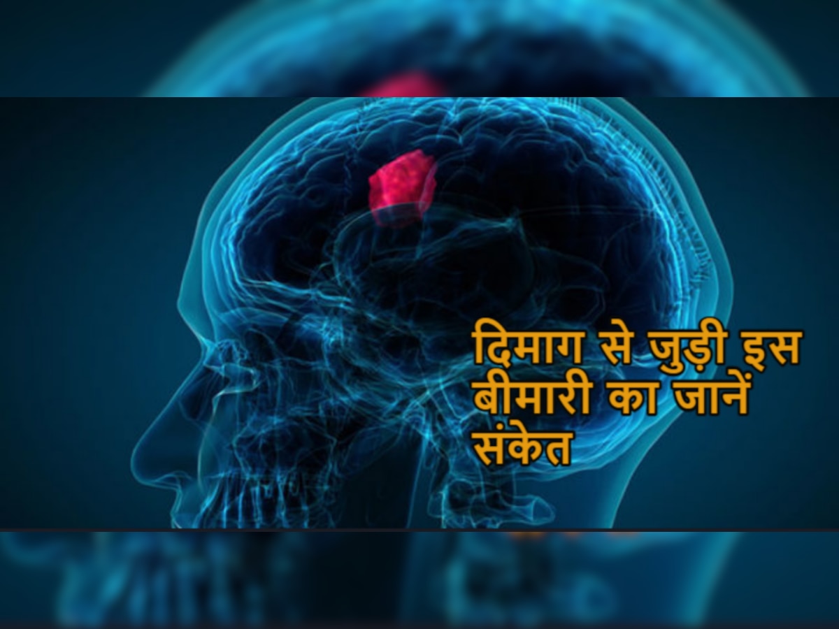 Brain Disease: भूलकर भी ब्रेन ट्यूमर के इन लक्षणों को न करें नजरअंदाज, पड़ सकता है पछताना!