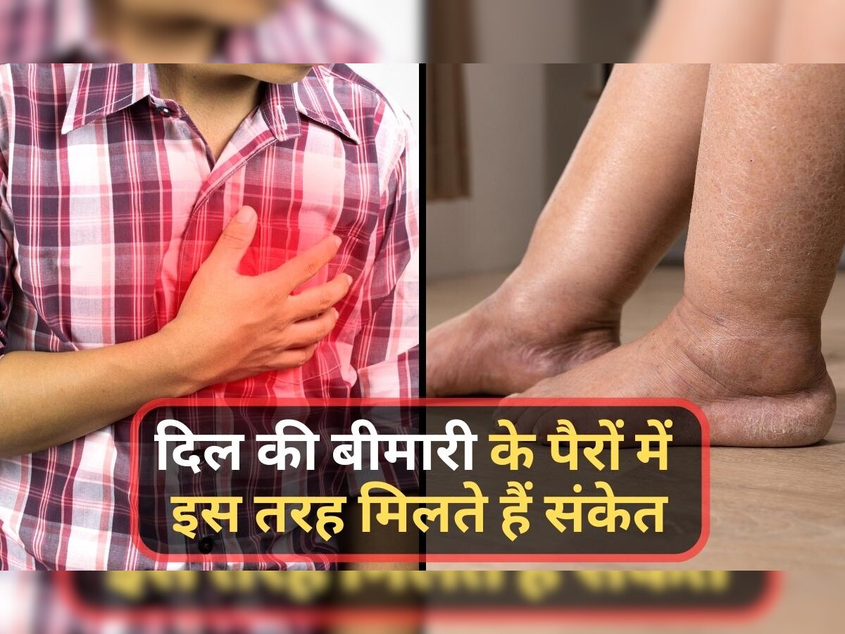 Heart Disease Symptoms: अगर पैरों में दिखे ये संकेत तो समझ जाएं दिल पर आने वाली है बड़ी आफत!