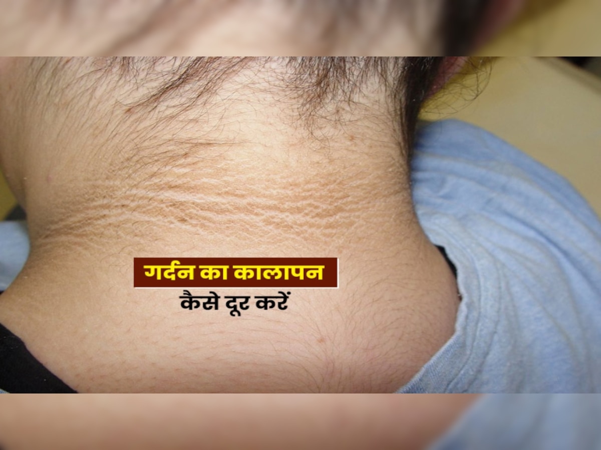 Neck Tanning: गर्दन पर पसीने से जम गया है मैल? ऐसे इस्तेमाल करें कच्चा पपीता, गंदगी होगी साफ