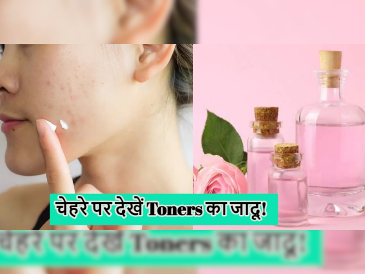 Pimple Treatment: चेहरे को बेदाग बनाने के लिए लीजिए एक हफ्ते का चैलेंज, डार्क स्पॉट्स पर लगाएं ये टोनर्स