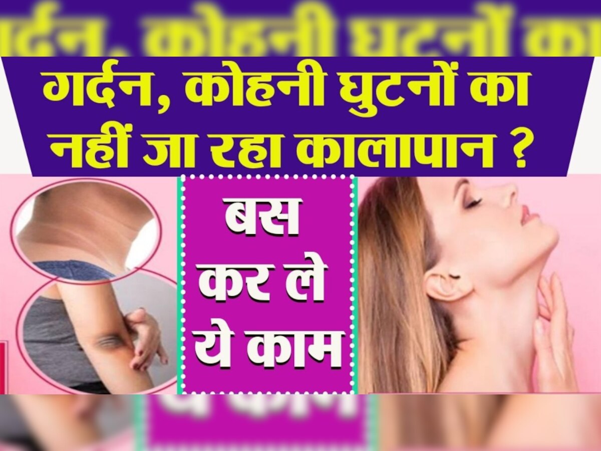 Tanning Removal: घर पर बनाएं बेकिंग सोडा-नींबू स्क्रब, रिमूव होगा कोहनी और घुटनों का कालापन