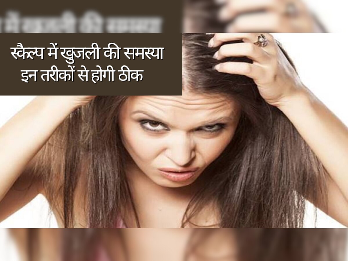 Hair Care Tips: स्कैल्प में खुजली की समस्या से हैं परेशान? अपनाएं ये घरेलू तरीके, दिक्कत होगी दूर