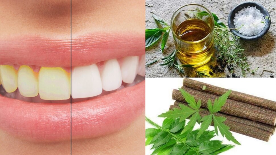 Teeth Whitening Tips Teeth start shining with home remedies daato ki
