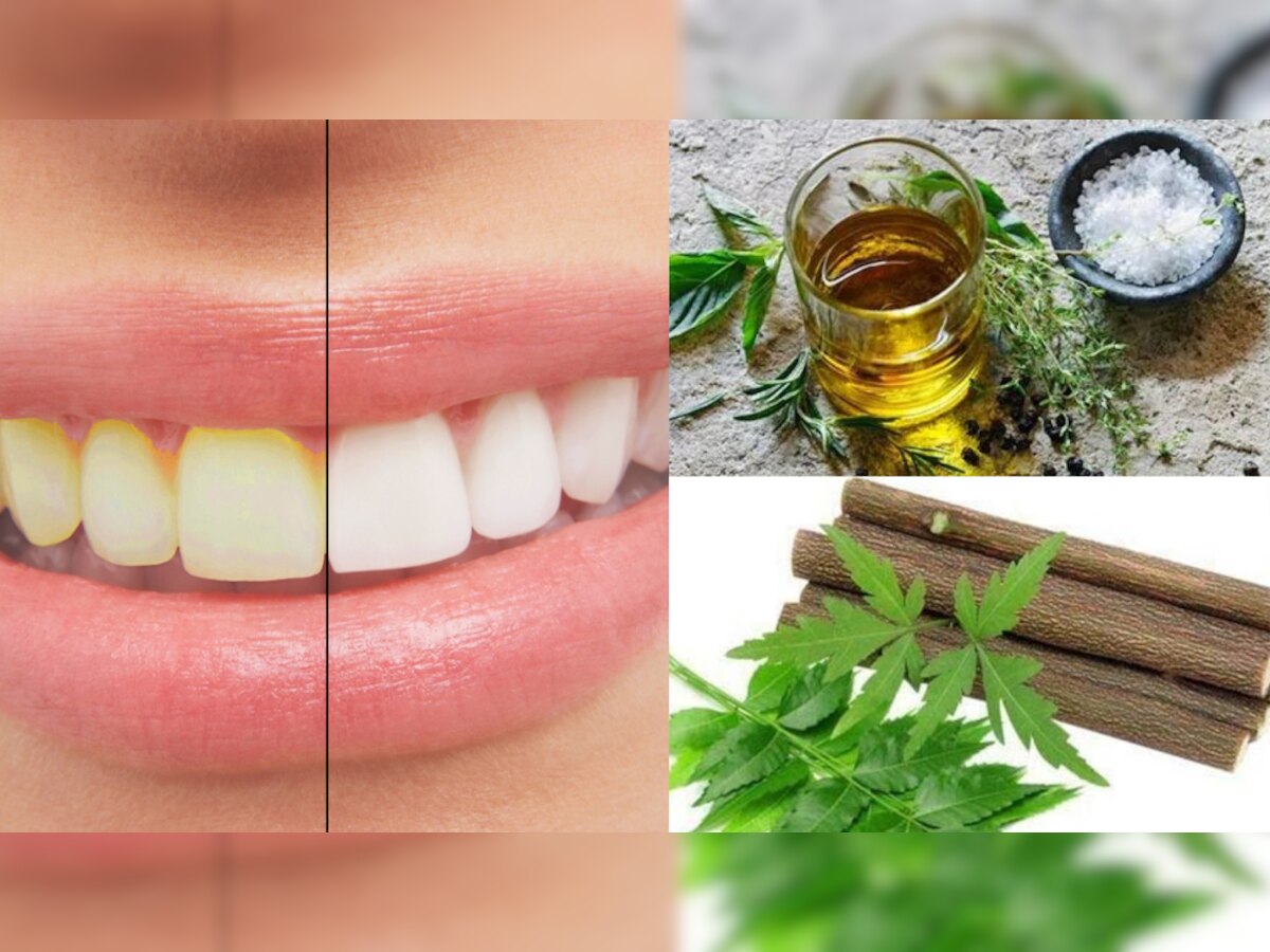 Teeth Whitening Tips:पीले दांतों से हैं परेशान, अपनाएं ये घरेलू नुस्खें, हीरे की तरह आ जाएगी शाइनिंग