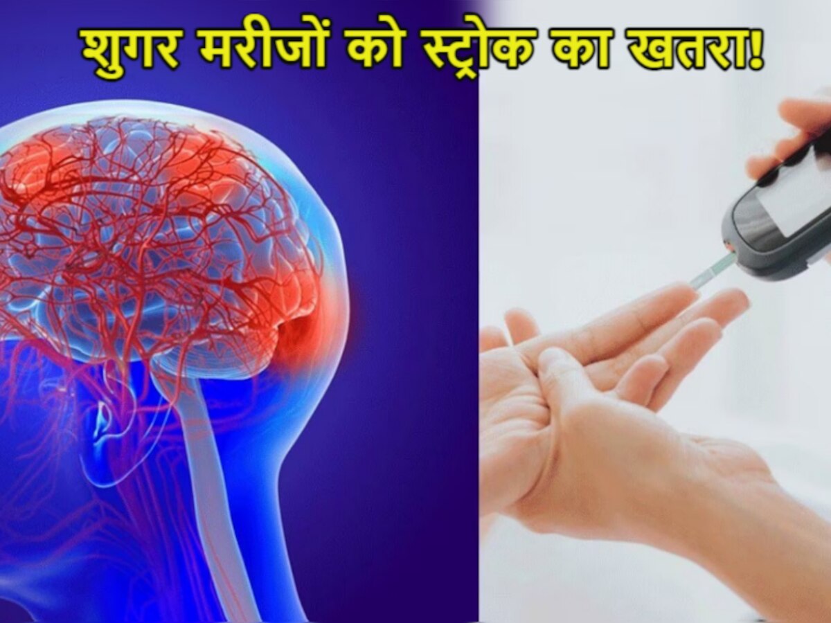 Stroke Symptoms: क्या डायबिटीज मरीजों को भी हो सकता है स्ट्रोक? अध्ययन बताता है सच...