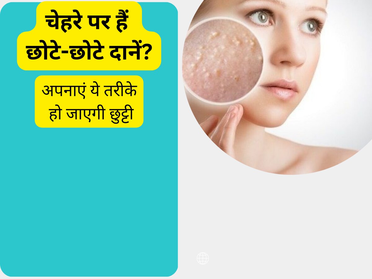 skin care tips home remedies to remove small pimples on face Skin Care