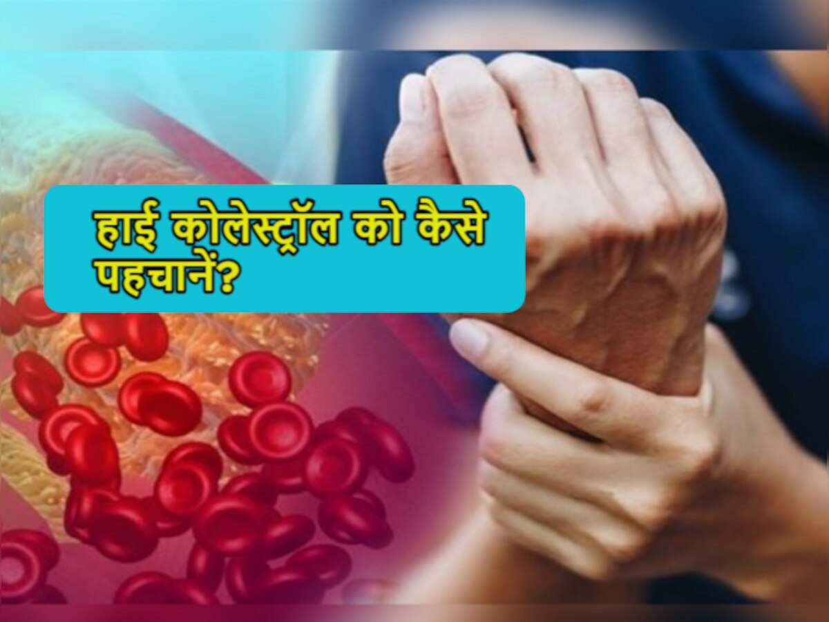 Bad Cholesterol के बढ़ने से पहले हो जाएं अलर्ट! शरीर देने लगता है ऐसे संकेत... 