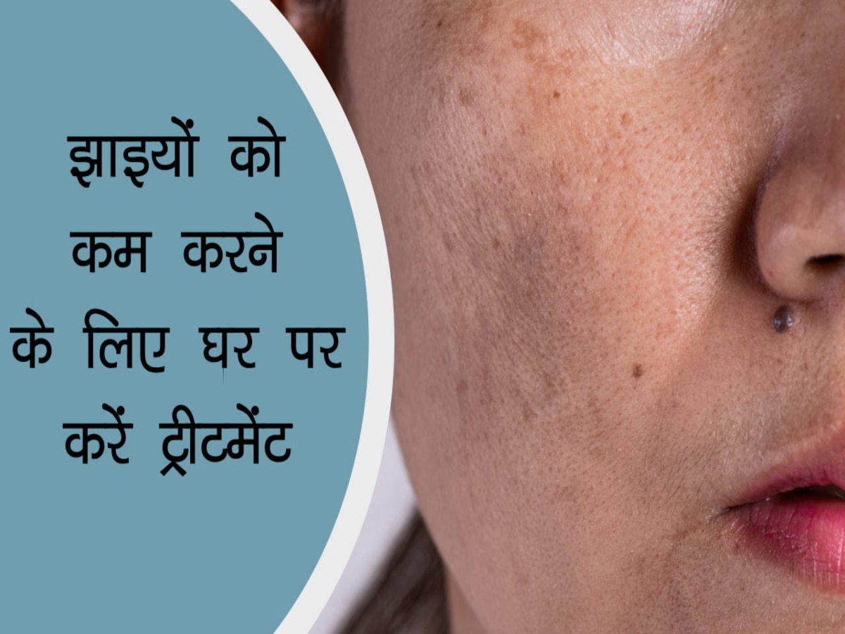 How To Reduce And Prevent pigmentation dark spots | Hindi News, छाछ से ...