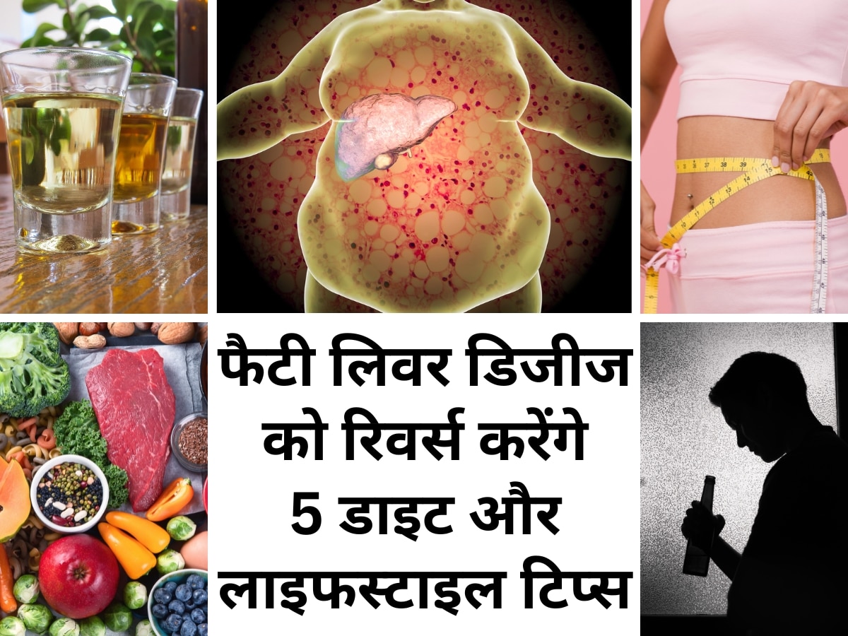 Reverse Fatty Liver Disease With These 5 Diet And Lifestyle Tips Fatty Liver Disease को रिवर्स