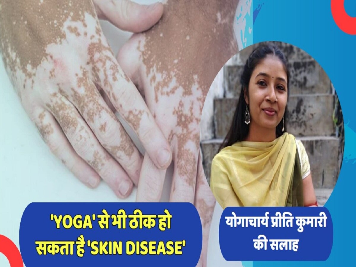 'Yoga' से भी ठीक हो सकता है 'Skin Disease', आप भी हैं परेशान तो आजमाकर देखें