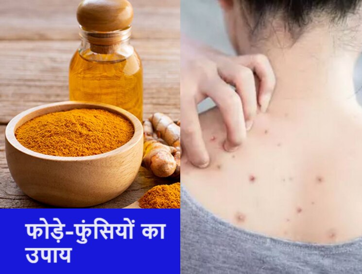 turmeric oil benefits on skin boils and pimples in summers know how to make at home Turmeric