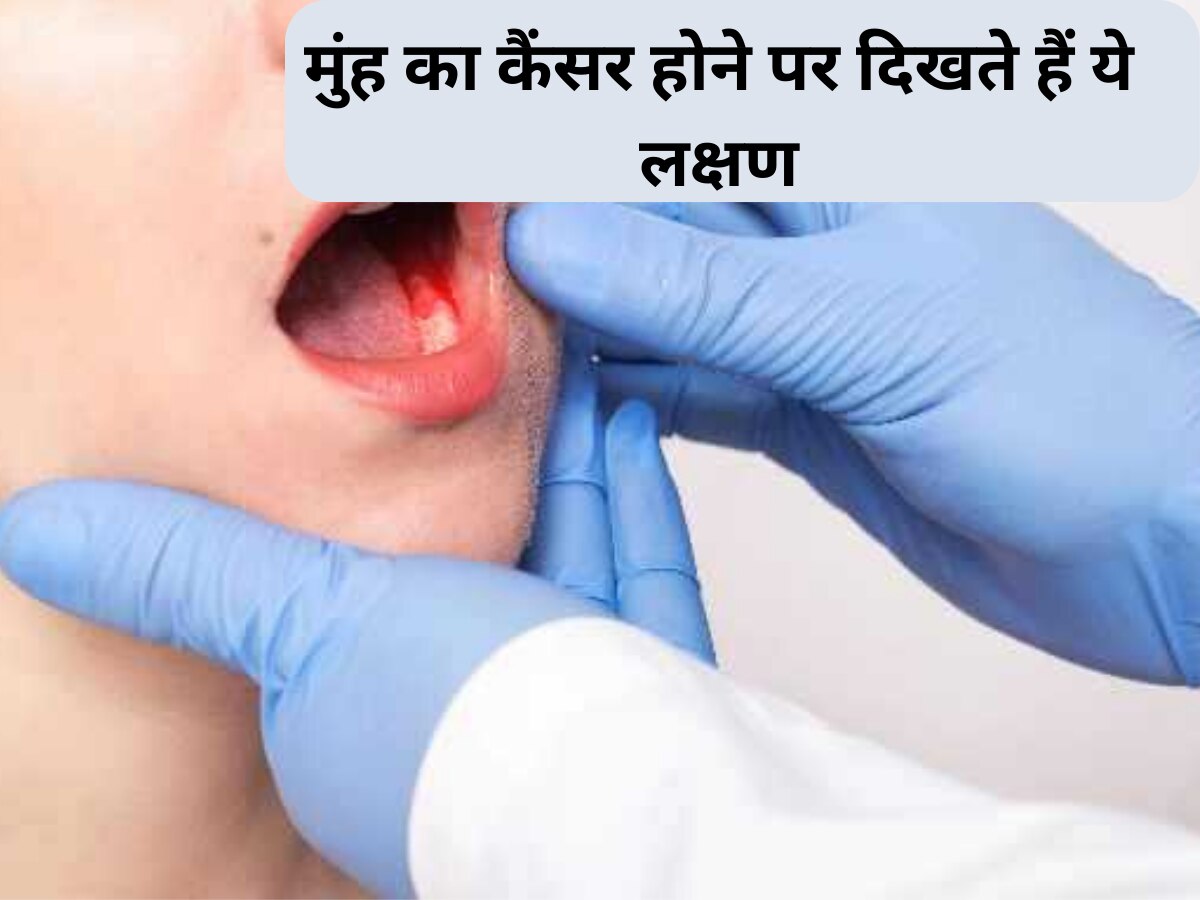 Health Tips: मुंह में दिखें ये लक्षण तो हो जाएं सावधान,  हो सकती है कैंसर जैसी जानलेवा बीमारी