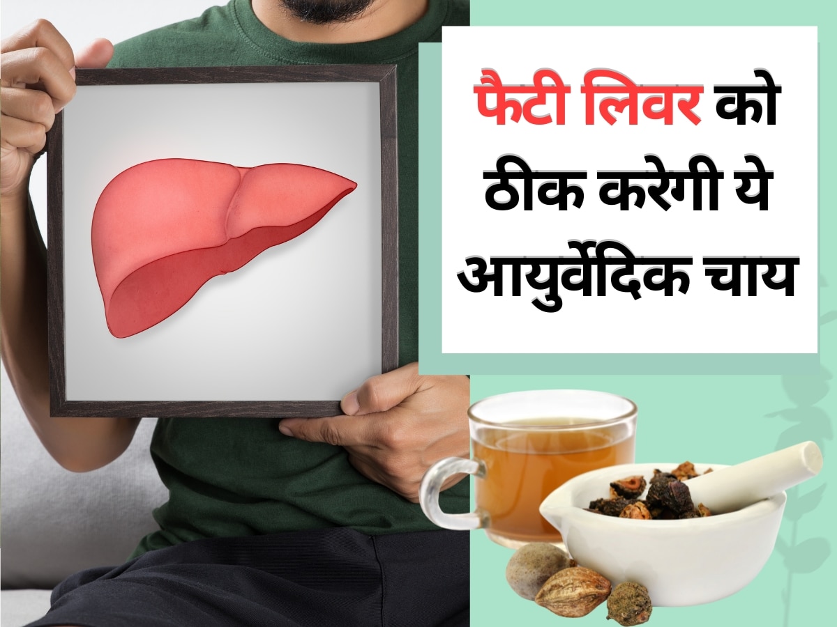 Ayurvedic tea will to cure fatty liver disease naturally and your liver