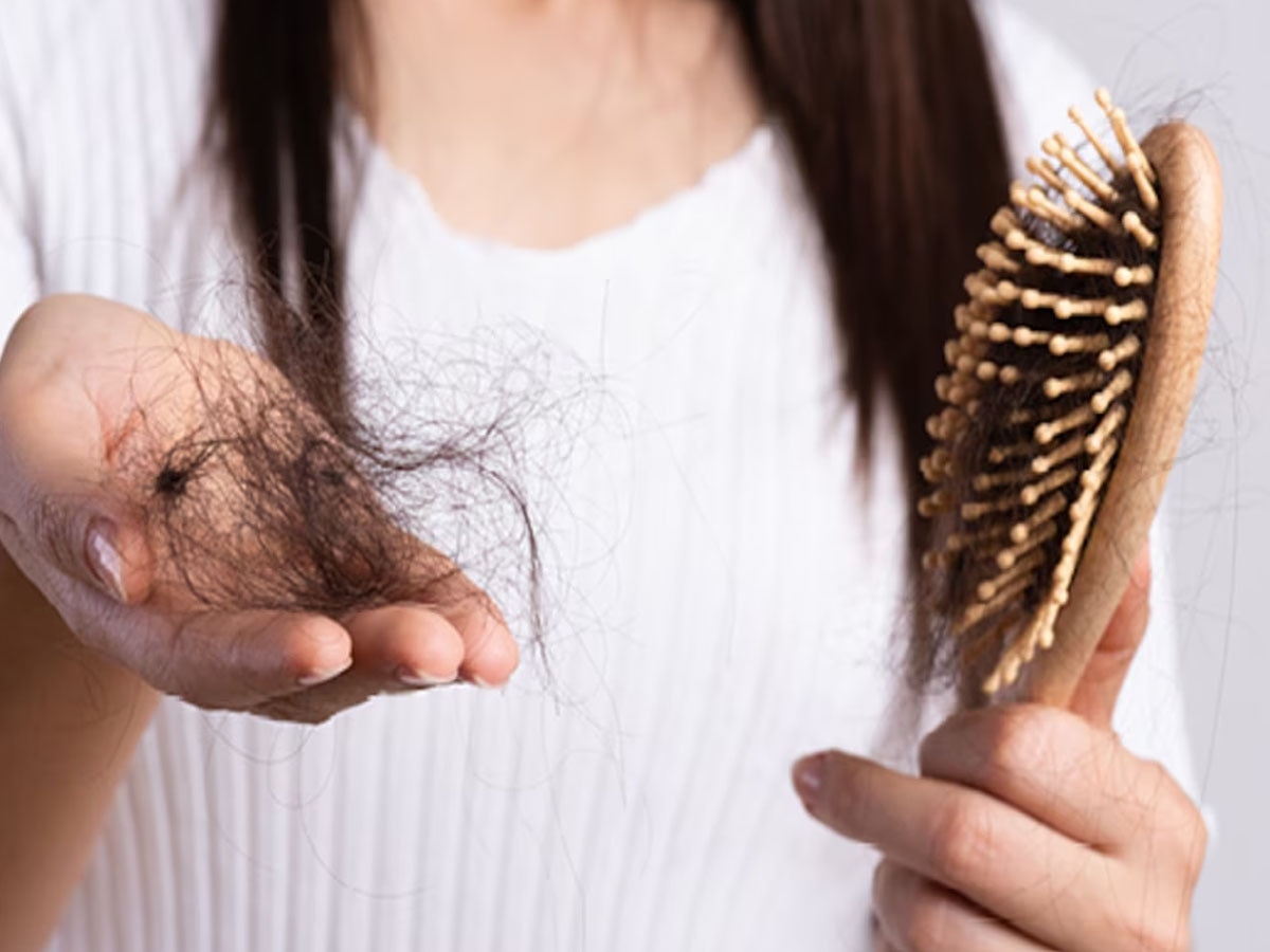 Hair Fall Remedies: कंघी करते ही हाथों में आ जाता है बालों का गुच्छा? नारियल तेल में ये रस मिलाकर कर लें मालिश, पहले की तरह हो जाएंगे घने- काले