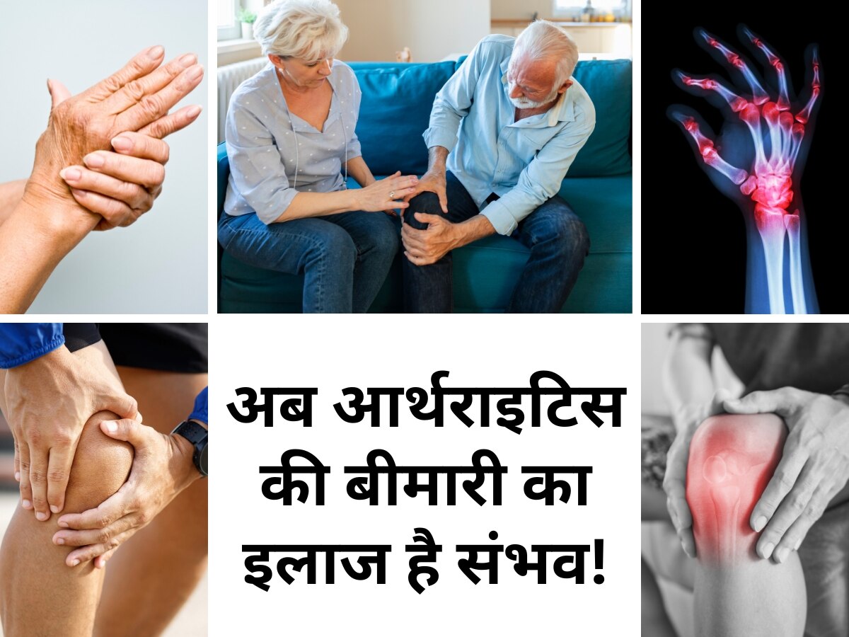 Now treatment of arthritis is possible Indian scientists discovered new