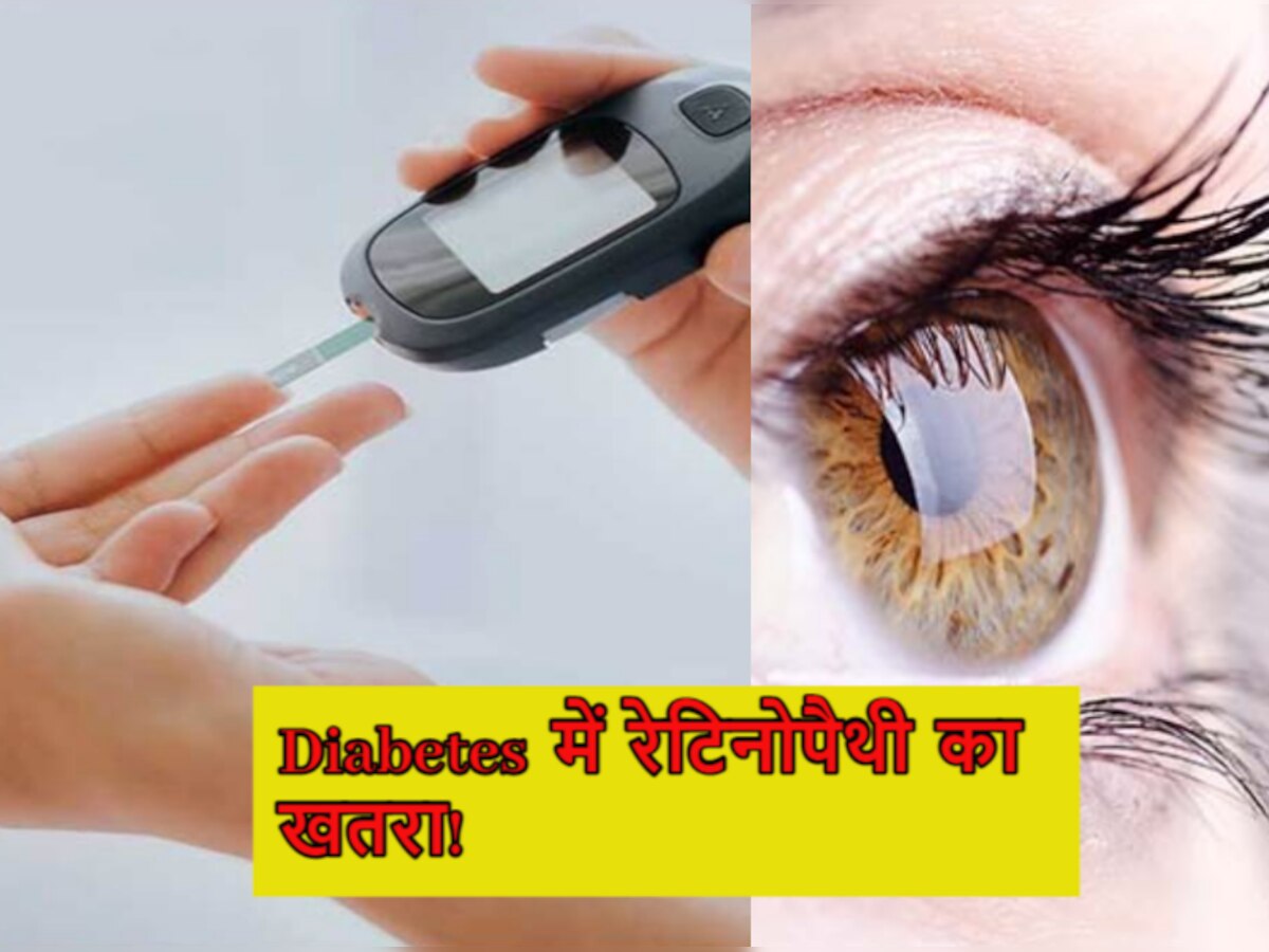 Eye Care: शुगर पेशेंट्स आंखों का रखें खास ख्याल, वरना हो सकती है रेटिनोपैथी की शिकायत!