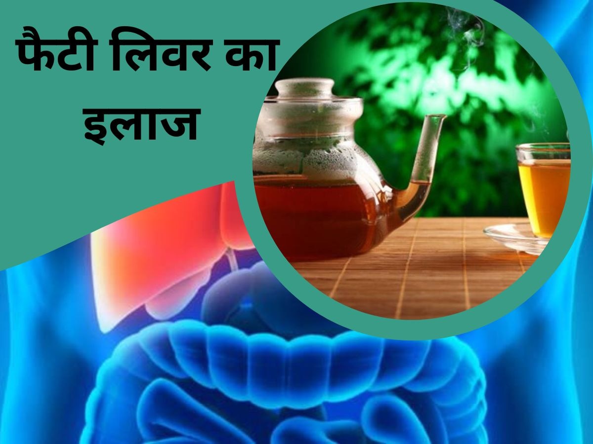 Ayurvedic Tea Benefits: जान ले सकती है फैटी लिवर की बीमारी! ये खास चाय करेगी इलाज