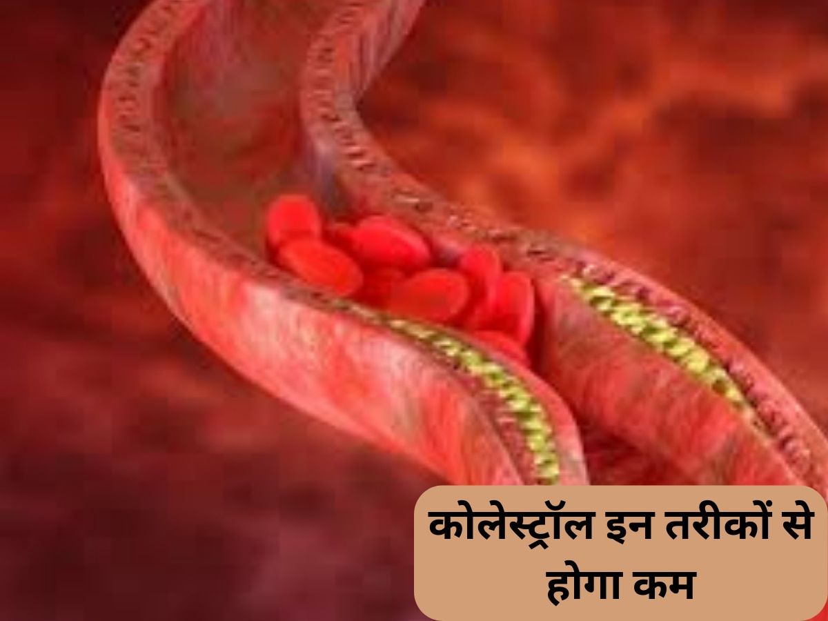 health tips dirty cholesterol spoils the nerves cholesterol kam kaise