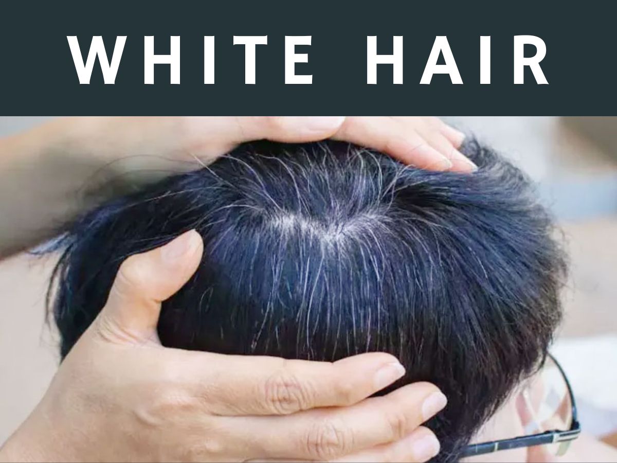 Oil For Premature White Hair