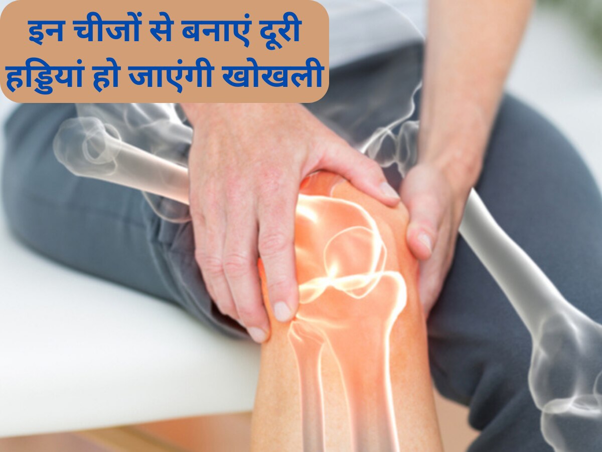 Calcium Deficiency: इन चीजों से फौरन बनाएं दूरी, नहीं तो शरीर की हड्डियां हो जाएंगी खोखली