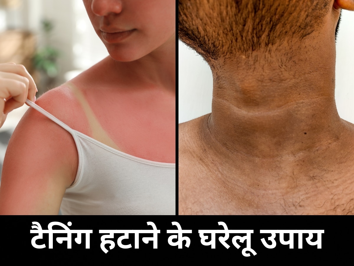 Sun Tan Removal: धूप ने हाथ, पैर और गर्दन को कर दिया है काला? हल्दी में 2 चीजें मिलाकर दूर करें कालापन