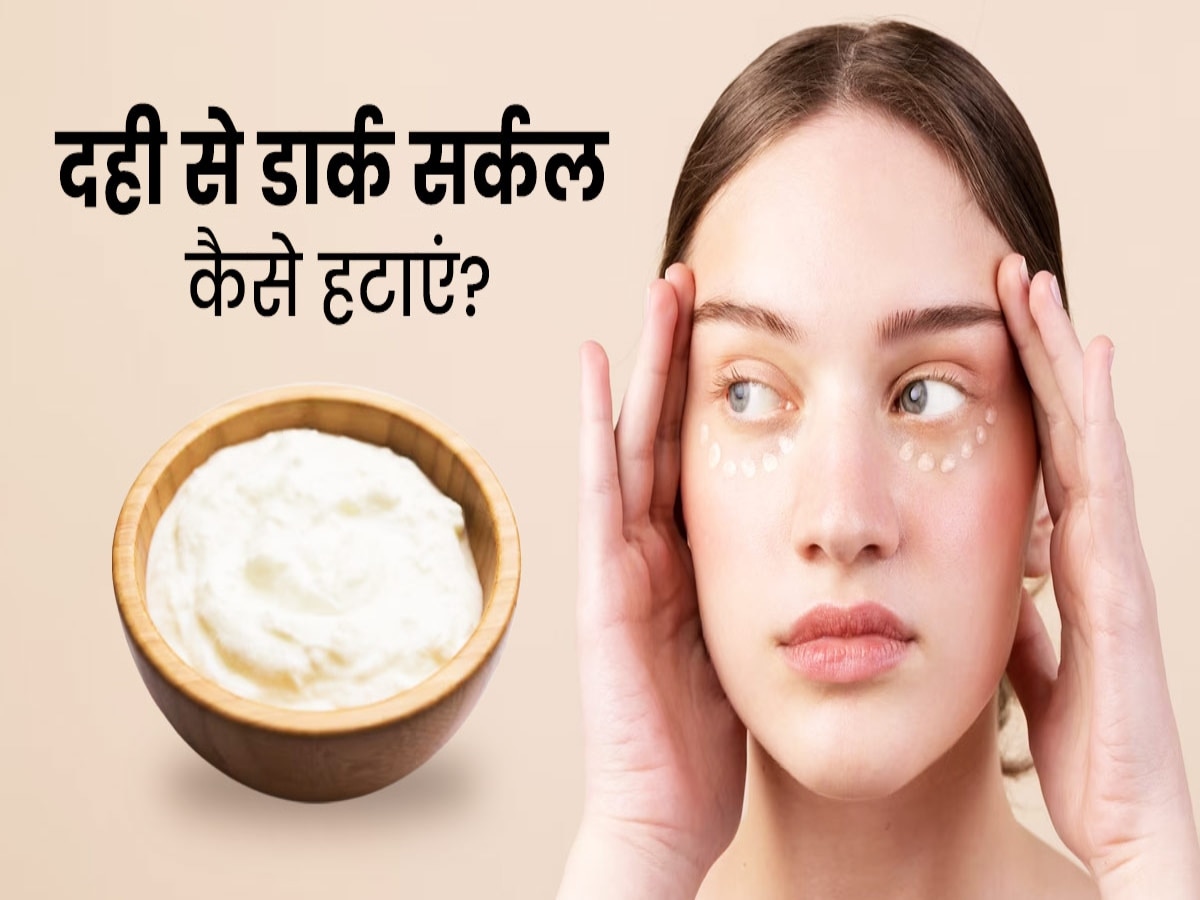 How To Make Dahi Under Eye Mask Dark Circles Solution Hindi News, दही