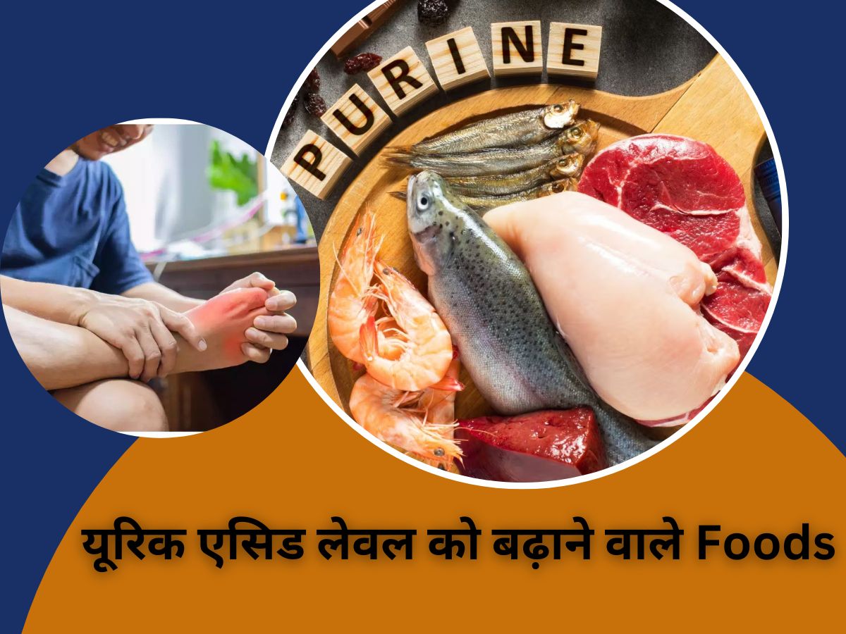 do not eat these foods in diet uric acid level will increase can cause