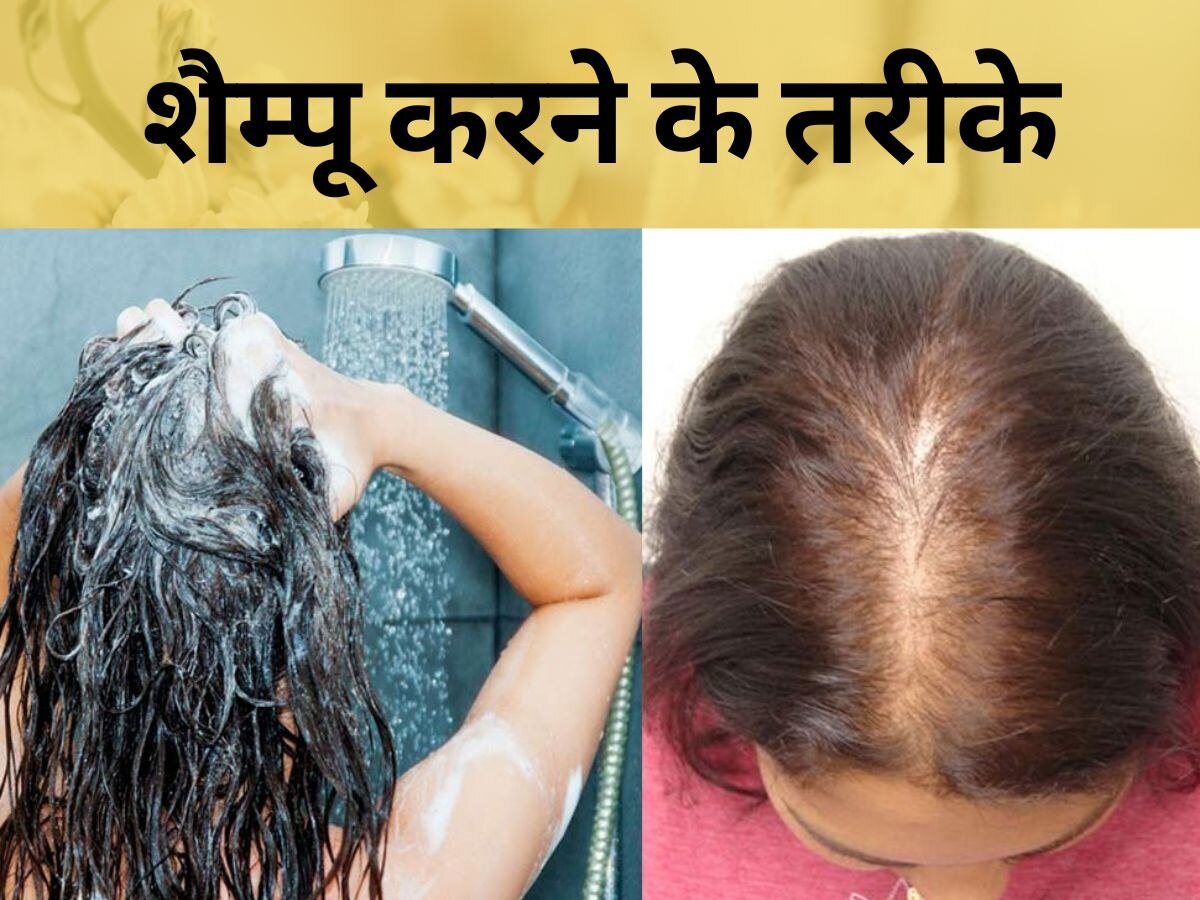 Hair Fall- गंजेपन का शिकार हो सकते हैं आप, Shampoo करते वक्त कभी न करें ऐसी गलतियां