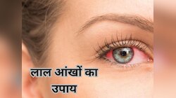 Eye Care: अगर आंखें दिखने लगी हैं लाल, तो घर पर तुरंत करें ये 5 काम, मिलेगी राहत