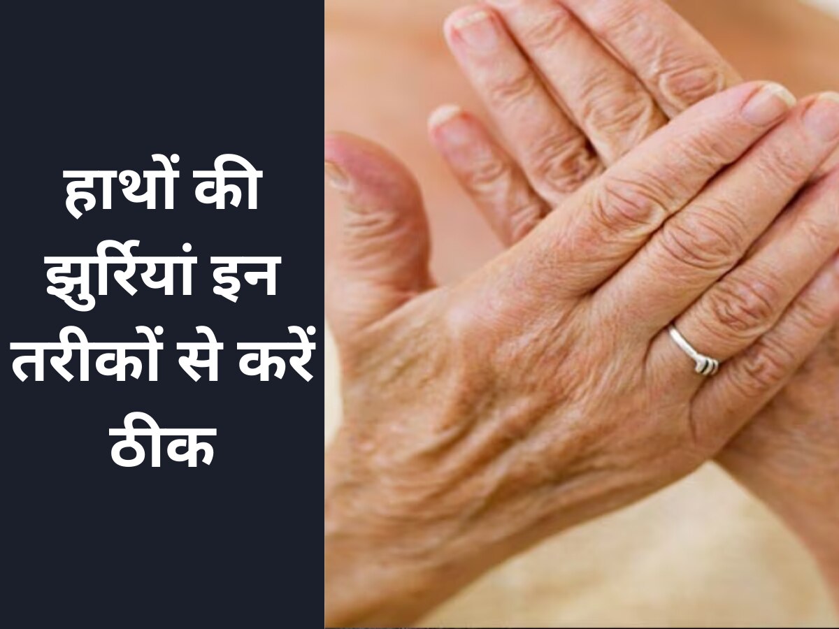 कम उम्र में ही हाथों में आने लगी हैं झुर्रियां? अपनाएं ये उपाय,हाथ बनेंगे खूबसूरत