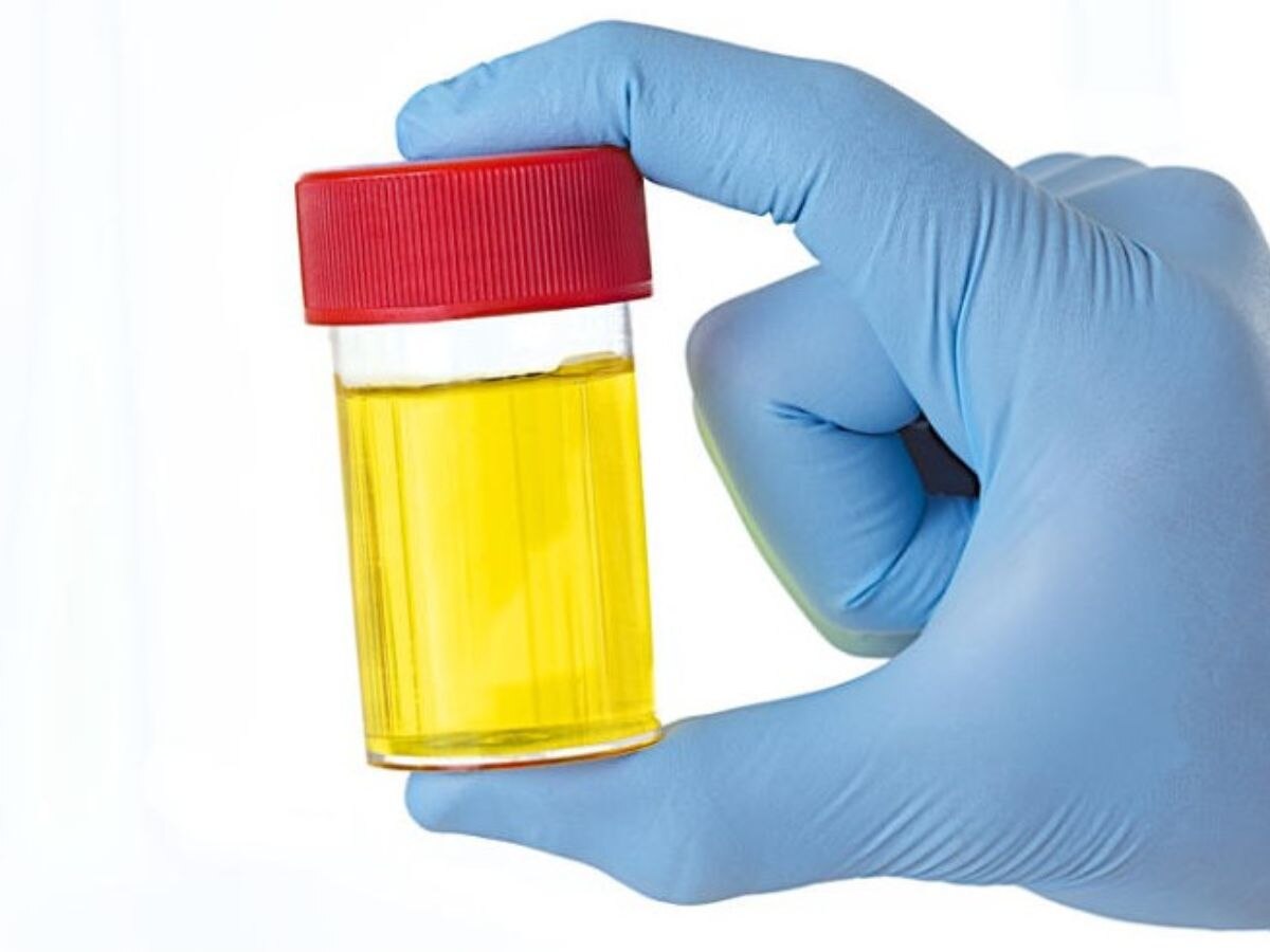 Health Benefits of Drinking Beetroot Juice for Skin Stomach Power