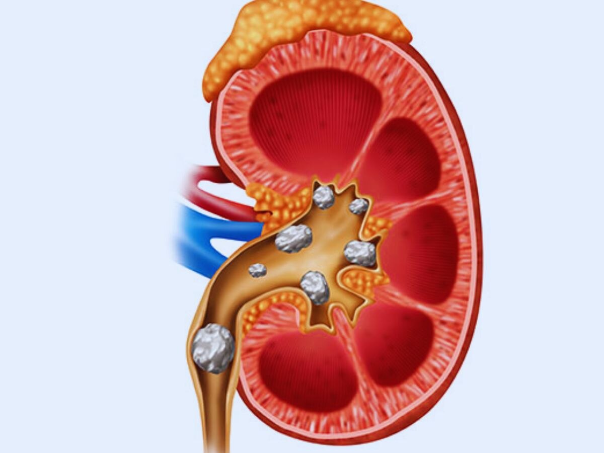 Health Benefits of Drinking Beetroot Juice for Skin Stomach Power