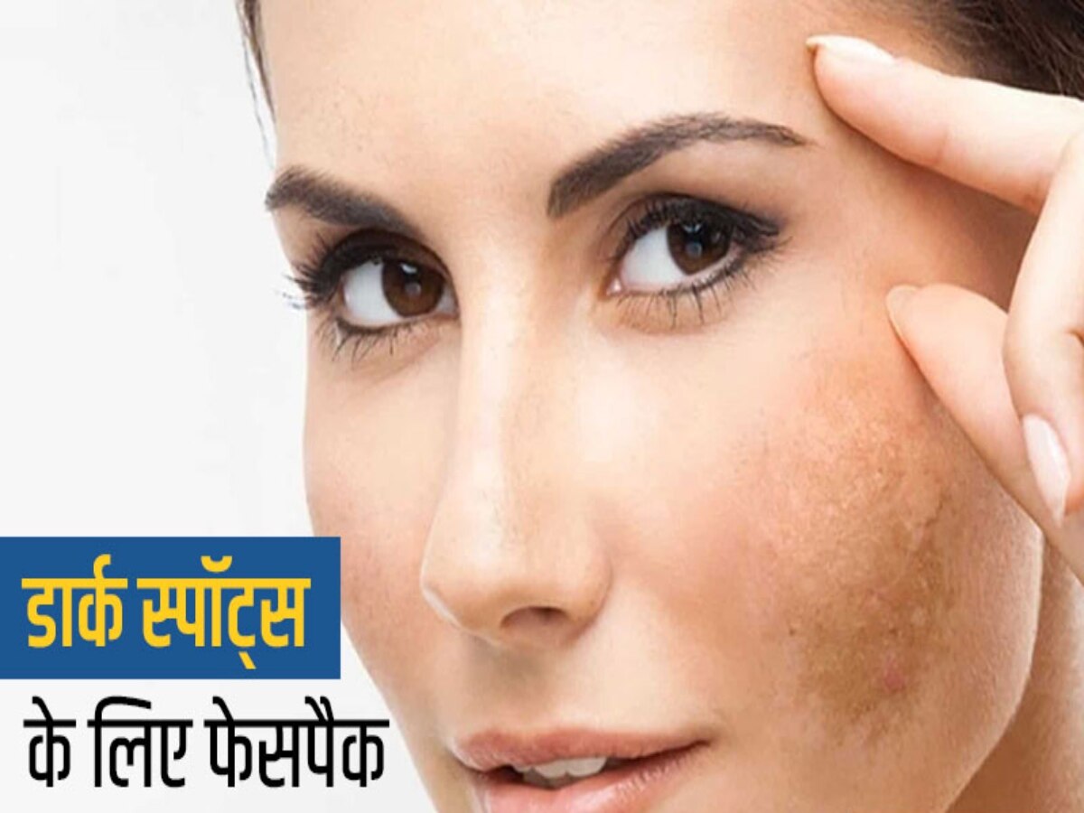 Dark Spots: पाना चाहते हैं स्पॉटलेस स्किन? तो चेहरे पर ऐसे लगाएं गाजर, त्वचा बनेगी बेदाग