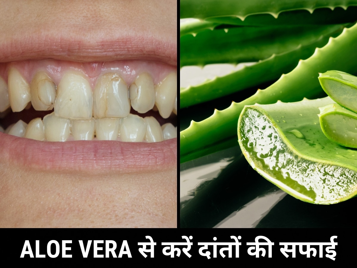 Aloe Vera Benefits: एलोवेरा से करें दांतों की सफाई, फायदे जानकर हैरान हो जाएंगे आप