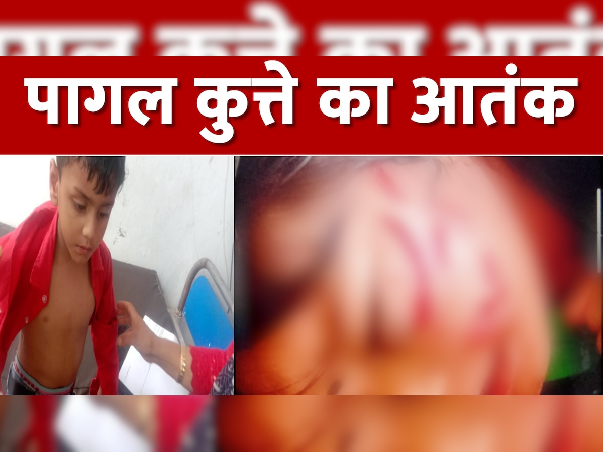 Uttarkashi News: पागल कुत्ते ने कई बच्चों को बनाया अपना शिकार, 2 बच्चों की हालत बेहद नाजुक
