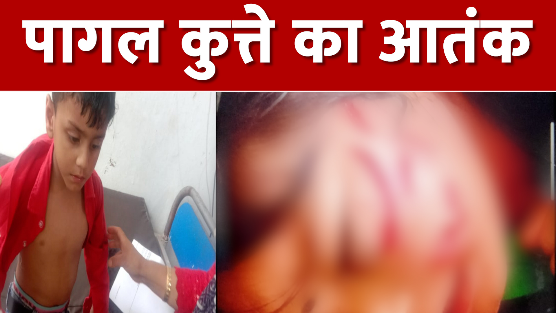 Uttarkashi News: पागल कुत्ते ने कई बच्चों को बनाया अपना शिकार, 2 बच्चों की हालत बेहद नाजुक Uttarkashi News: पागल कुत्ते ने कई बच्चों को बनाया अपना शिकार, 2 बच्चों की हालत बेहद नाजुक