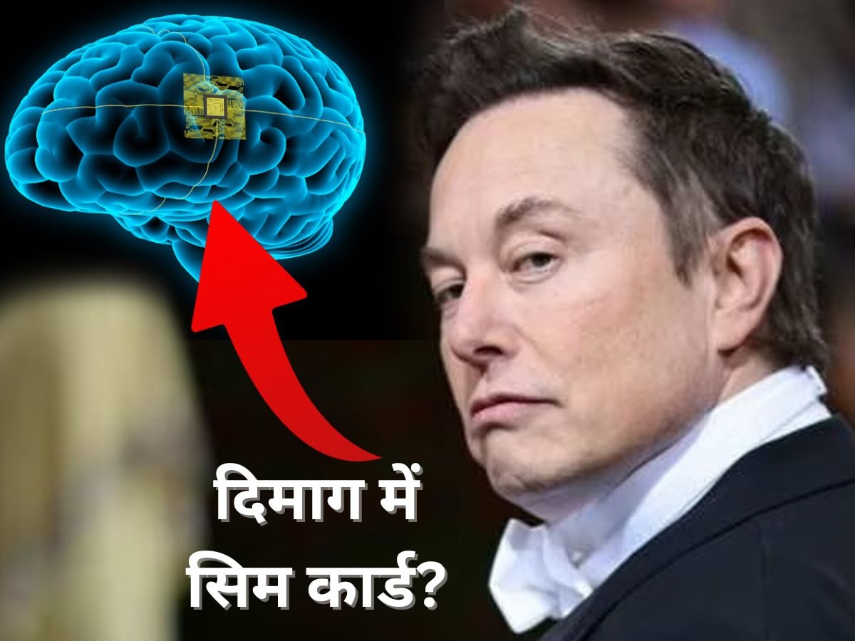 दिमाग में छेद करके सिम कार्ड लगाएंगे Elon Musk ! सरकार ने अप्रूव किया प्रोजेक्ट 