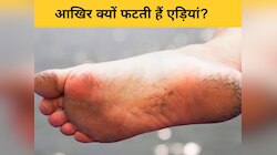 Cracked Heels: फटी एड़ियों के कारण होने लगा तेज दर्द, कहीं इन Vitamin की कमी तो नहीं