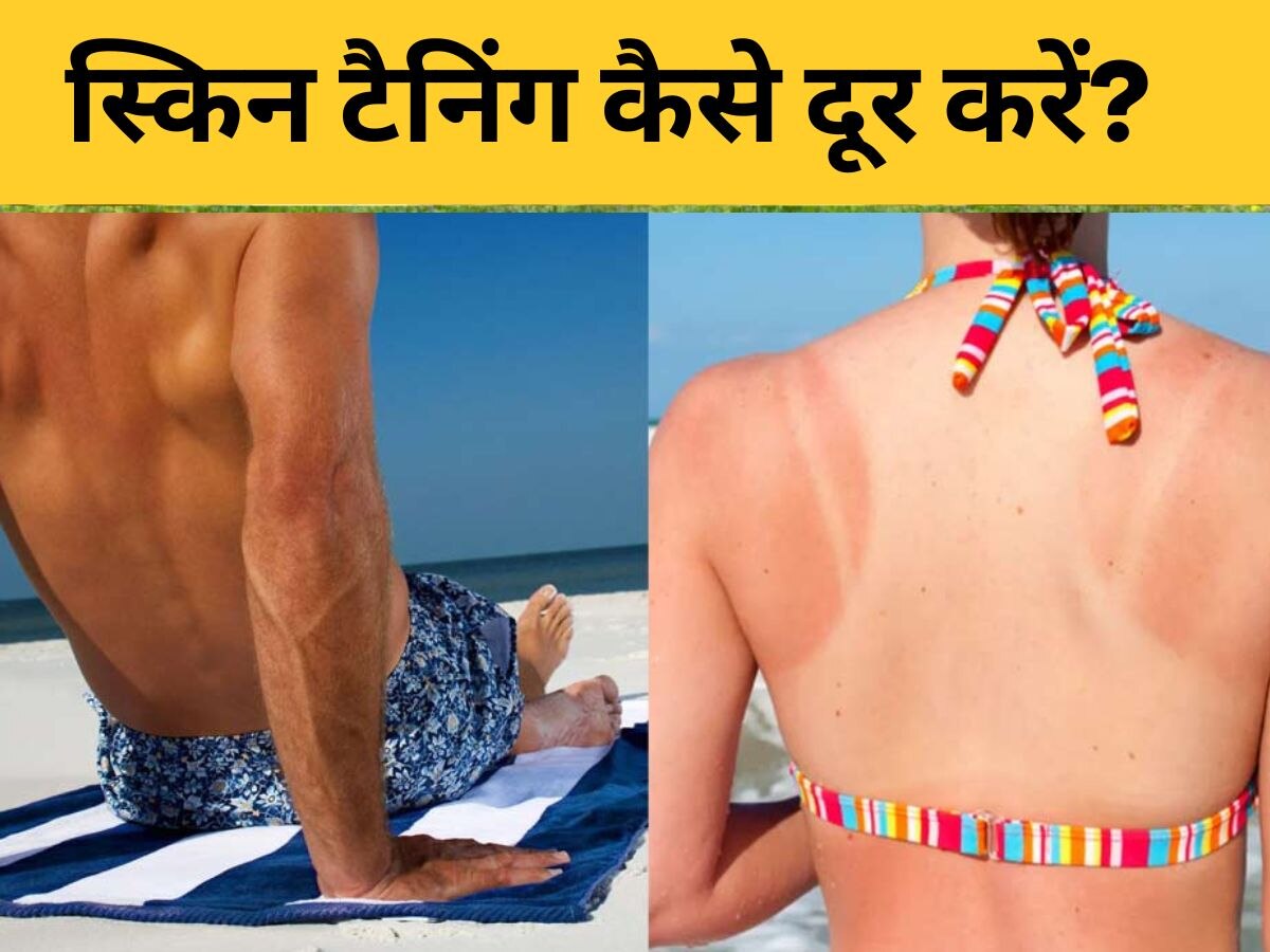 Skin Tanning: तपती धूप में घूमने के कारण त्वचा हो गई टैन? जानिए वापस कैसे लाएं निखार