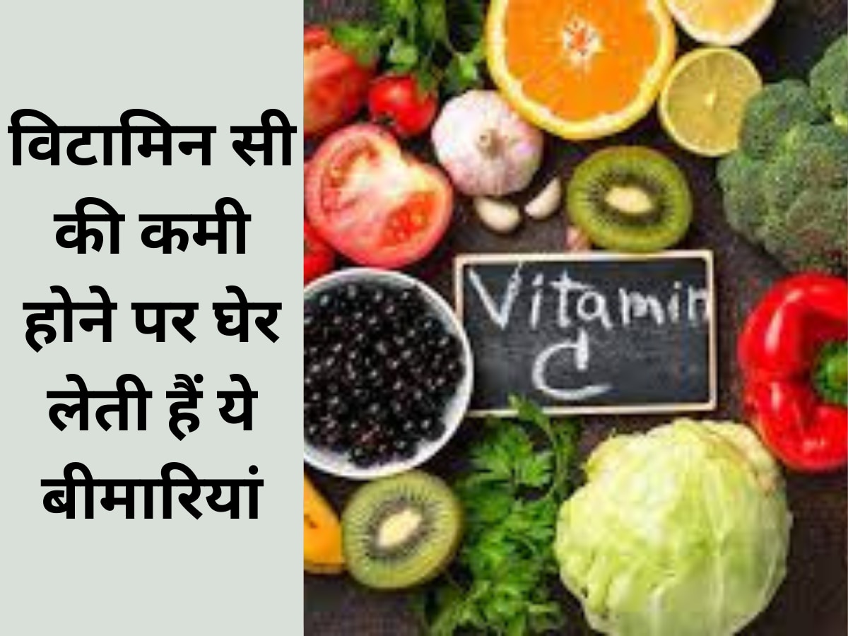 Vitamin-C: विटामिन सी की कमी होने पर घेर लेती हैं ये बीमारियां, इग्नोर करना पड़ सकता है भारी