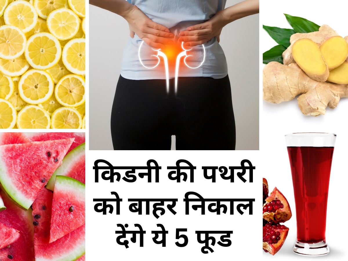 Kidney Detox: ये 5 फूड अशुद्धियों को करते हैं दूर, किडनी की पथरी भी जाएगी निकल